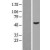 Western Blot: Cytokeratin 16 Lysate [NBL1-12383] - Western Blot experiments. 
Left-Control; Right -Over-expression Lysate for KRT16